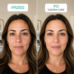 Valyra Retinal Shot™ - Booster z retinalem 0,1% na noc