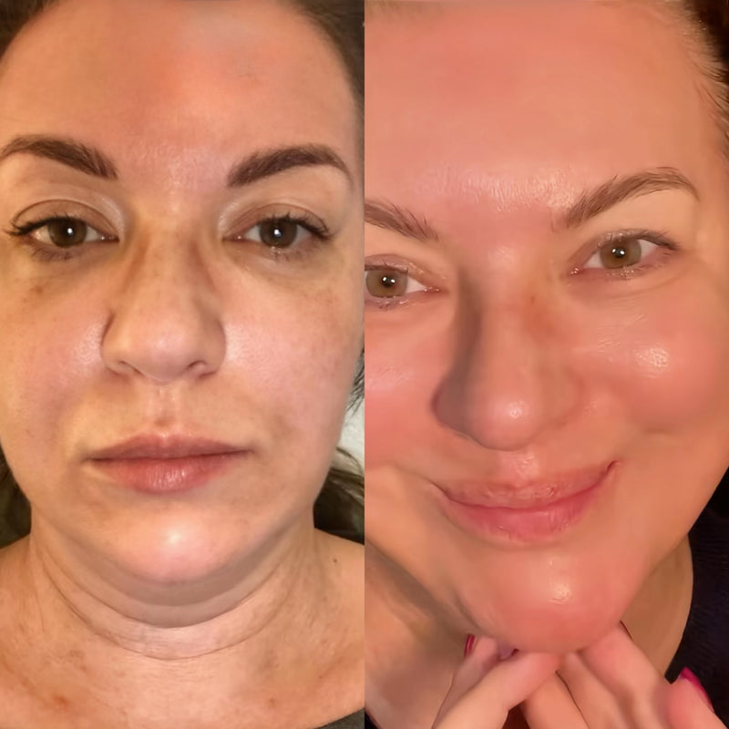 Carla B., 45