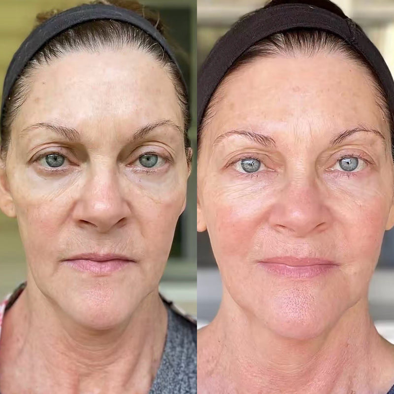 Francesca L., 54